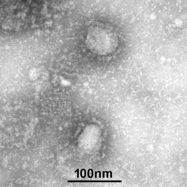 Scenario from an expert about a coronavirus from 3 months ago: 65 million people could die within 18 months